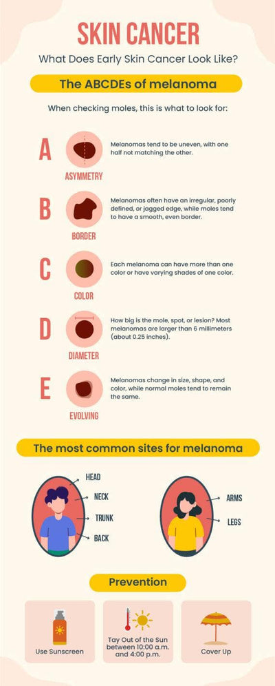 Health-Infographics Infographics Beige Skin Cancer Health Infographic Template powerpoint-template keynote-template google-slides-template infographic-template